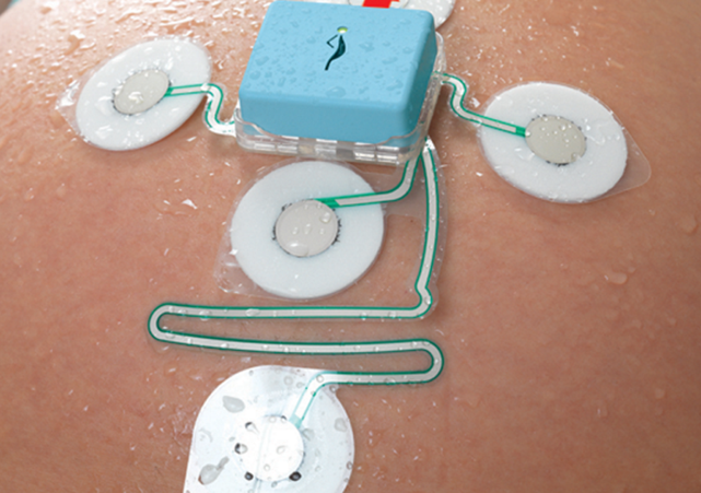 Novii Wireless Patch System by Monica Healthcare